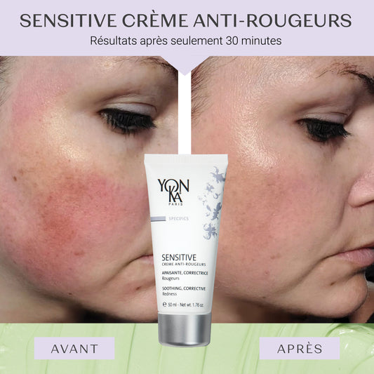 Sensitive Crème Anti-Rougeurs